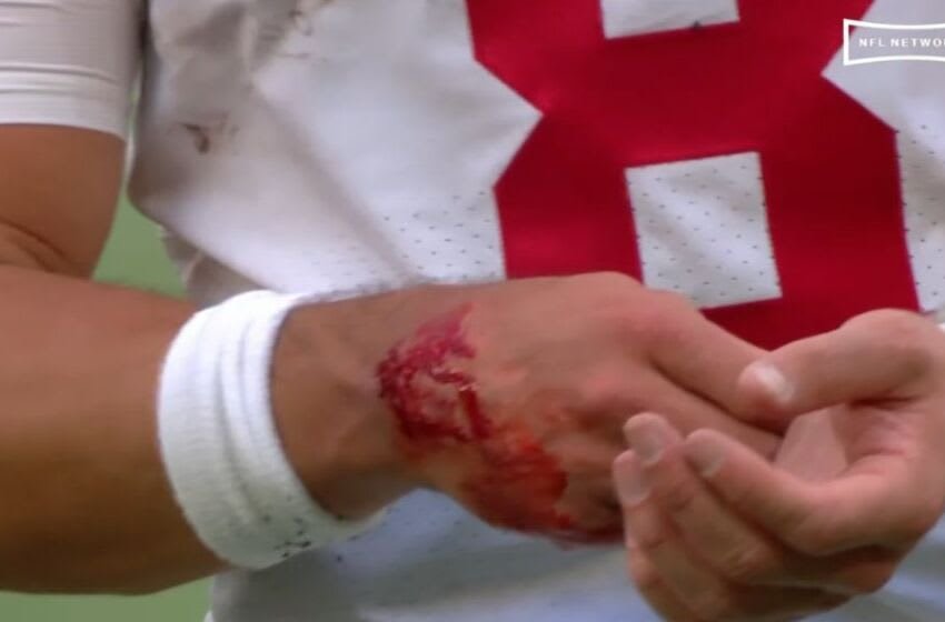Daniel Jones with a bloody hand in Week 5 against the Green Bay Packers (image courtesy of NFL Network broadcast)